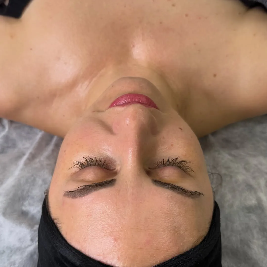 Tā pati seja pēc Collagen 90 procedūras – gludāka un mirdzošāka āda