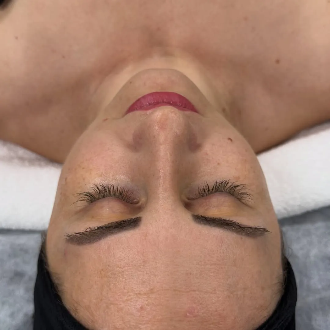 Seja pirms Collagen 90 procedūras, skats no augšas